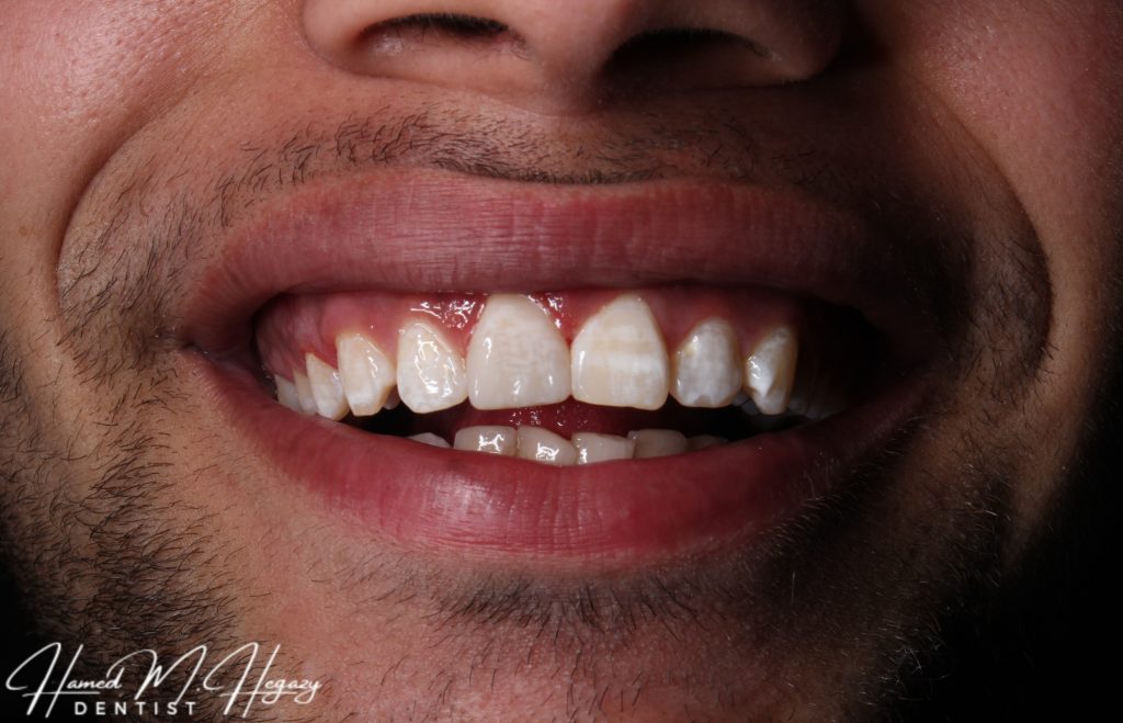 Picsart_25-02-15_17-06-02-897