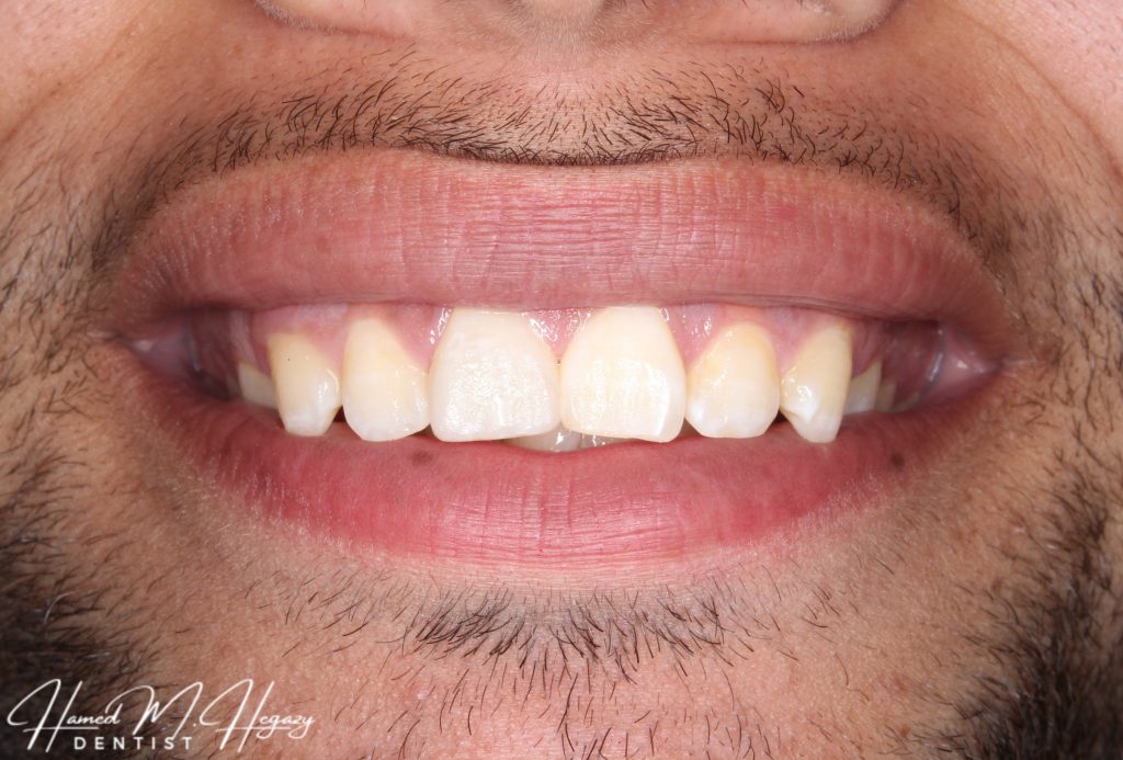 Picsart_25-02-15_19-07-18-442