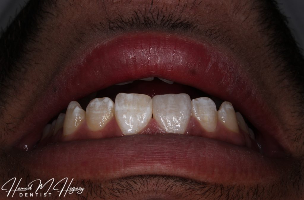 Picsart_25-02-15_19-14-01-130