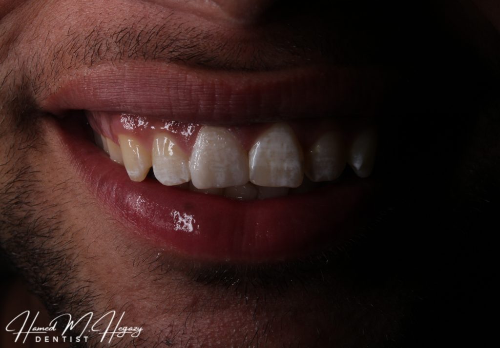 Picsart_25-02-15_19-17-42-757