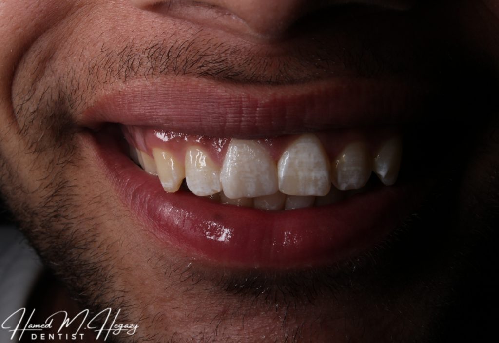 Picsart_25-02-15_19-19-01-379