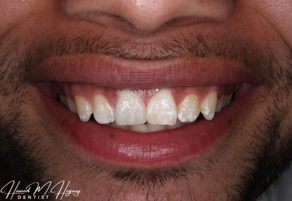 Picsart_25-02-15_19-24-12-206