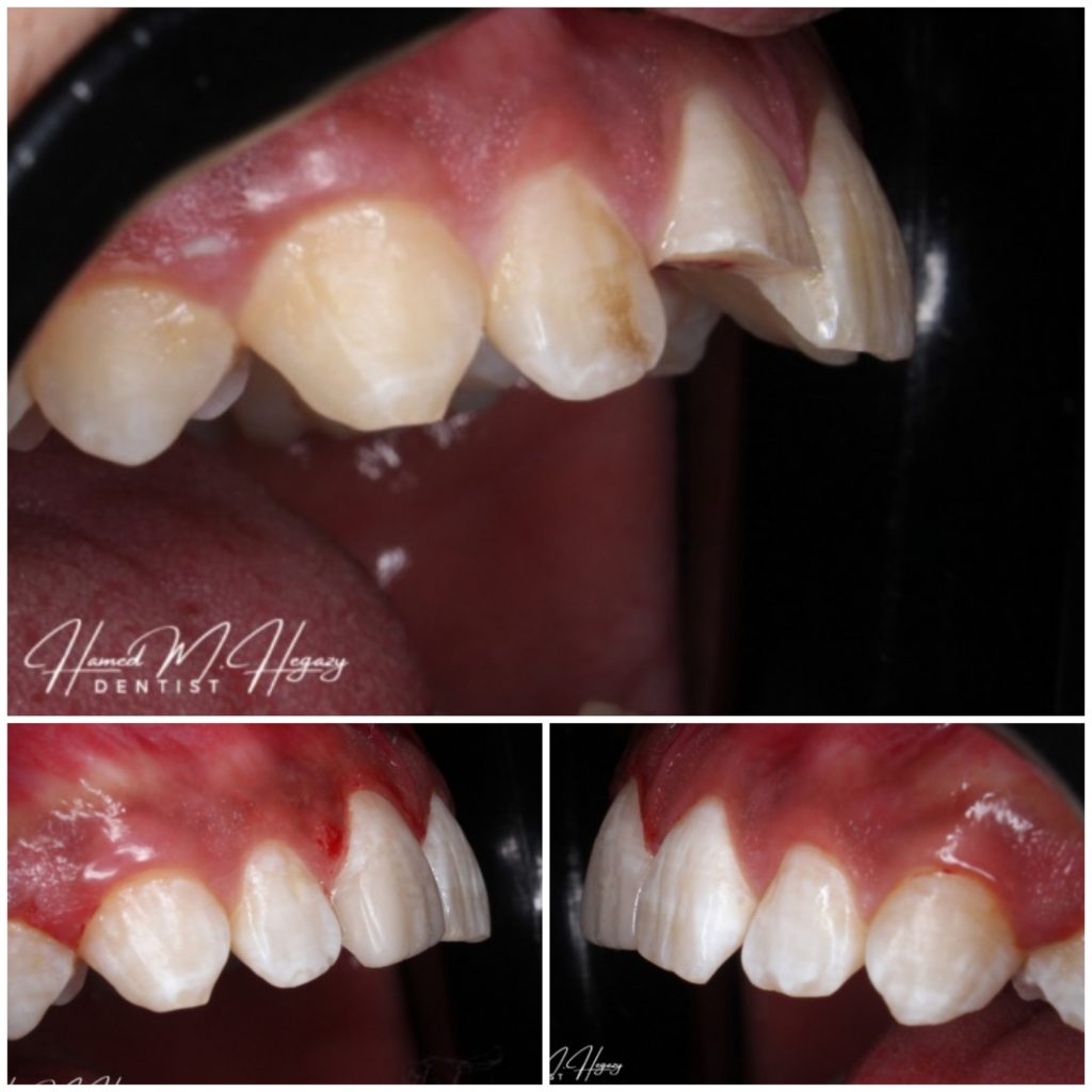 Picsart_25-02-15_19-48-11-163