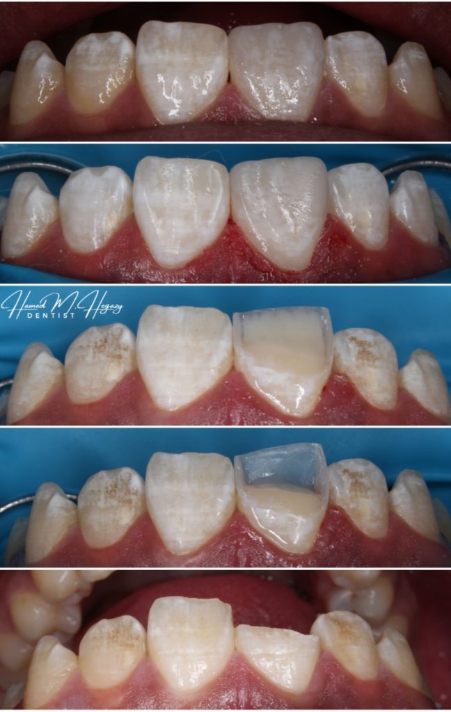 Picsart_25-02-15_20-03-53-246