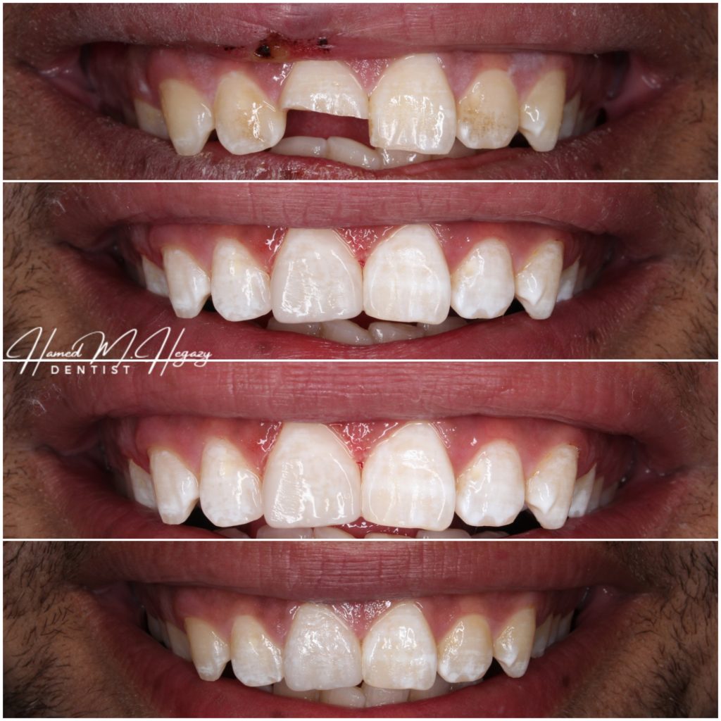 Picsart_25-02-15_23-33-19-391