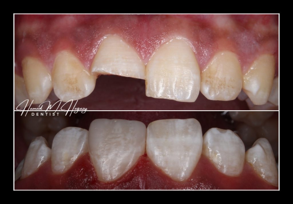 Picsart_25-02-15_23-43-36-412