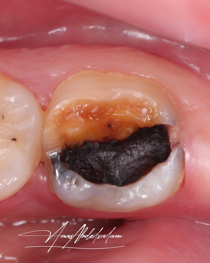 Picsart_25-05-10_19-30-28-136