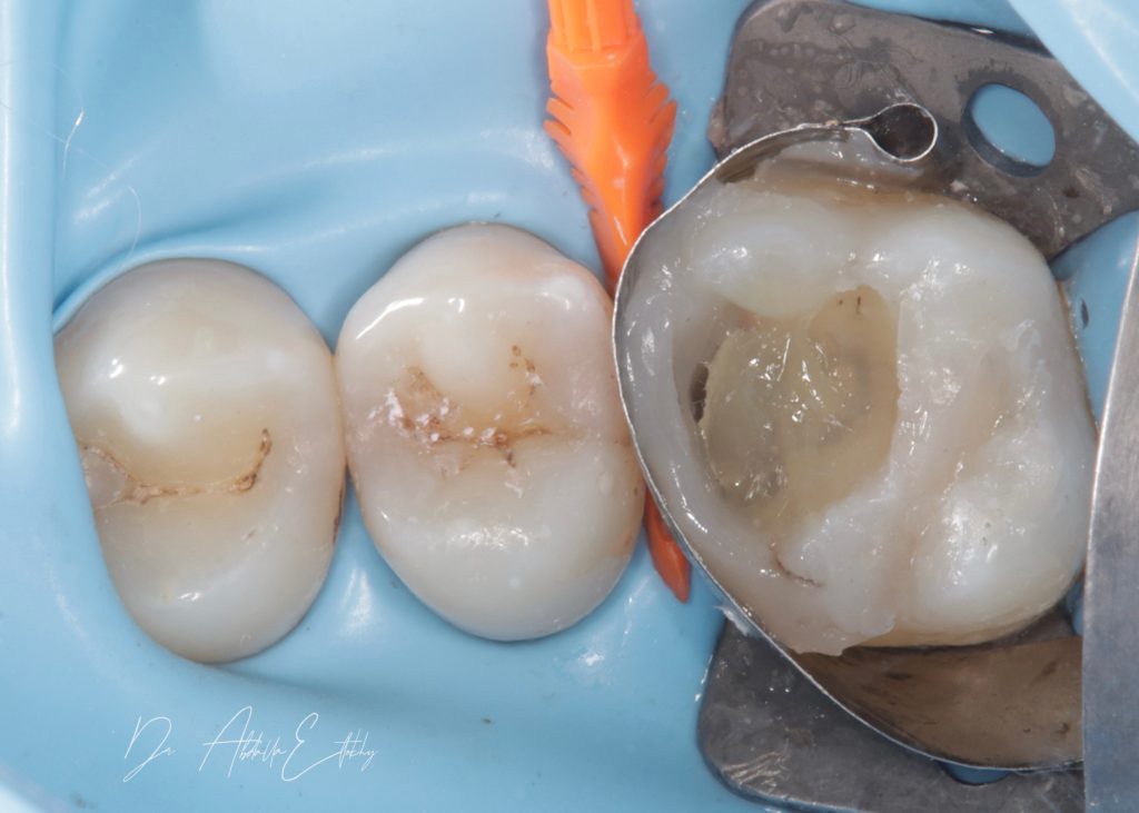 085AB736-44F9-4186-B42B-44C43846BEE6