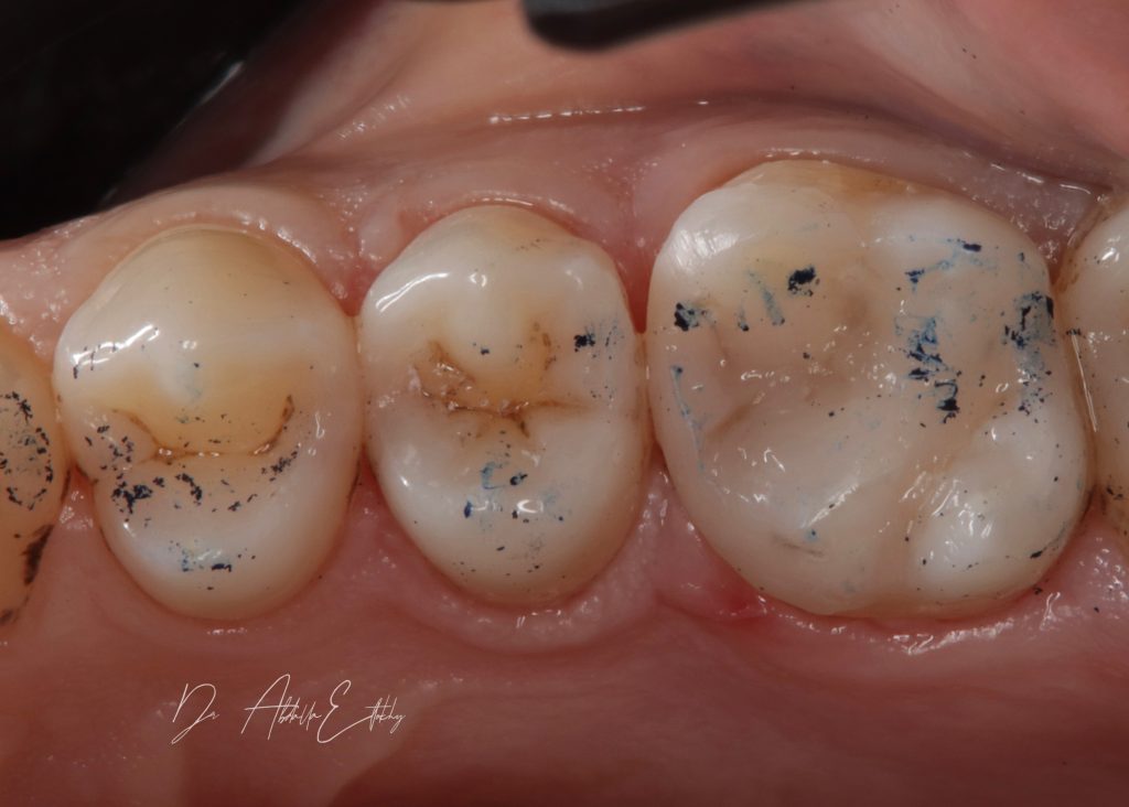 1CB0BA6B-6D45-48A7-8190-4CA759B5DA80