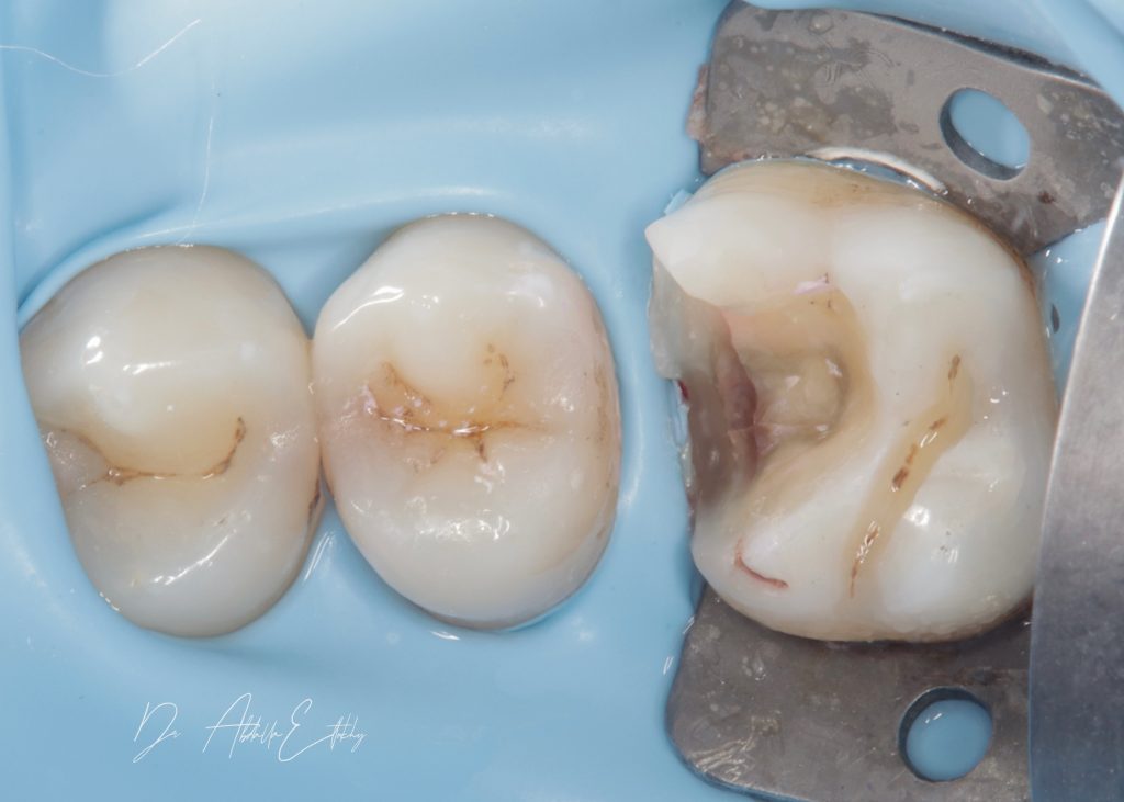 2EF87C4E-6DB6-4566-99AC-D6B56C451A96