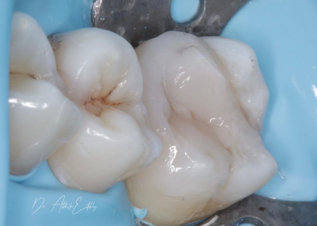 31401F0F-0C05-4223-8405-B6BE26685B84