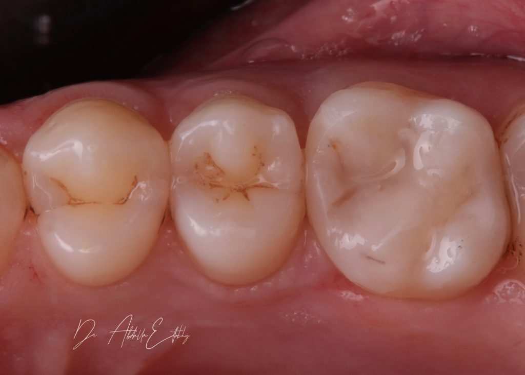 4DE36FC5-E181-4318-9FE8-F5A52BA5C20B