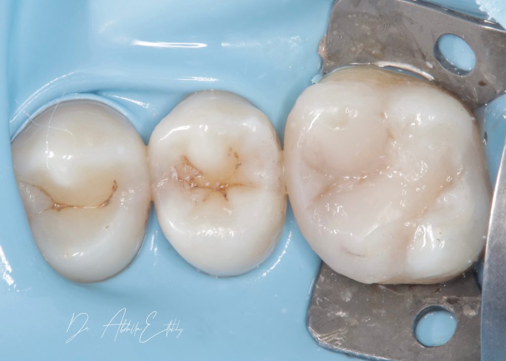 6FD0F982-1DAE-440A-BA91-27FDBF04342A