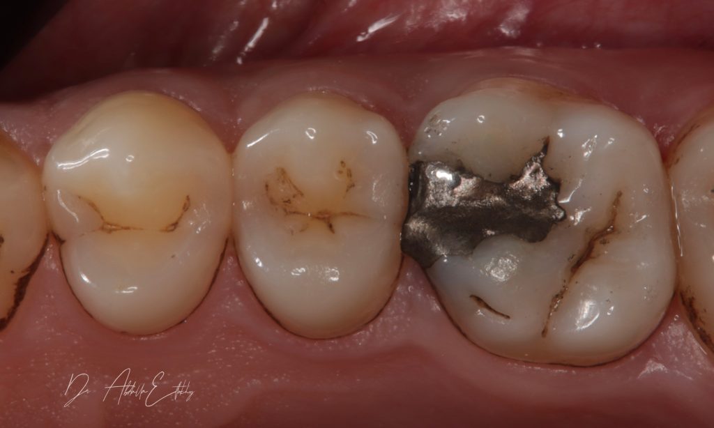 7FF98CAC-B420-4618-85CB-B09B7AD3182C