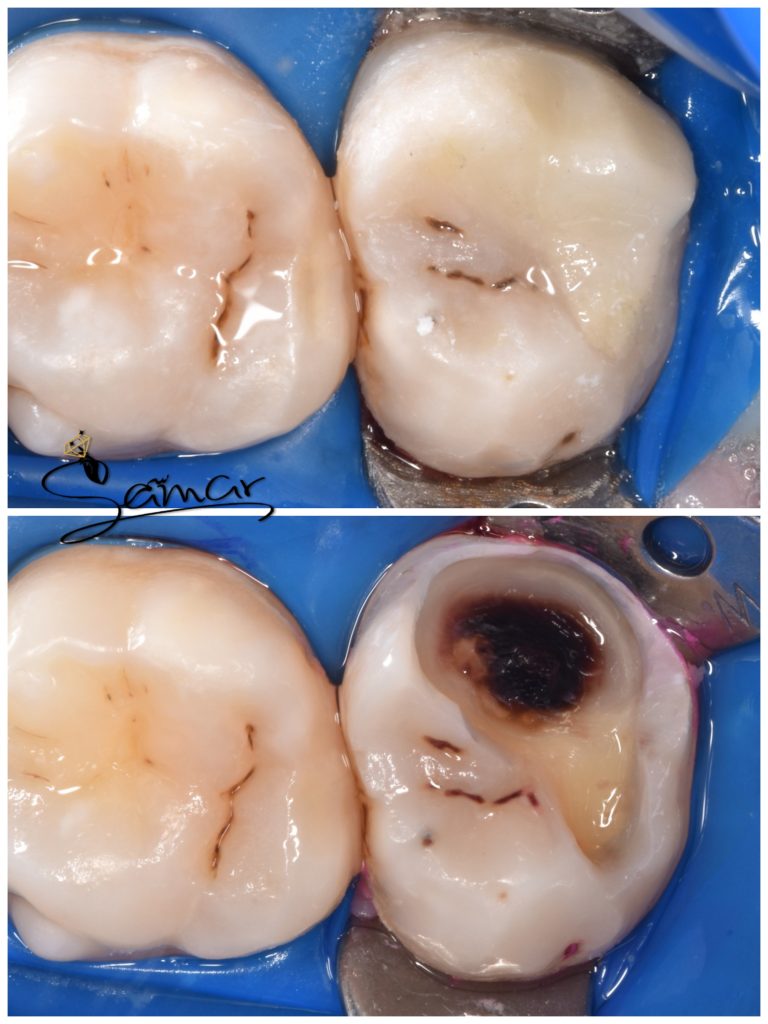 inbound1222233442525615765