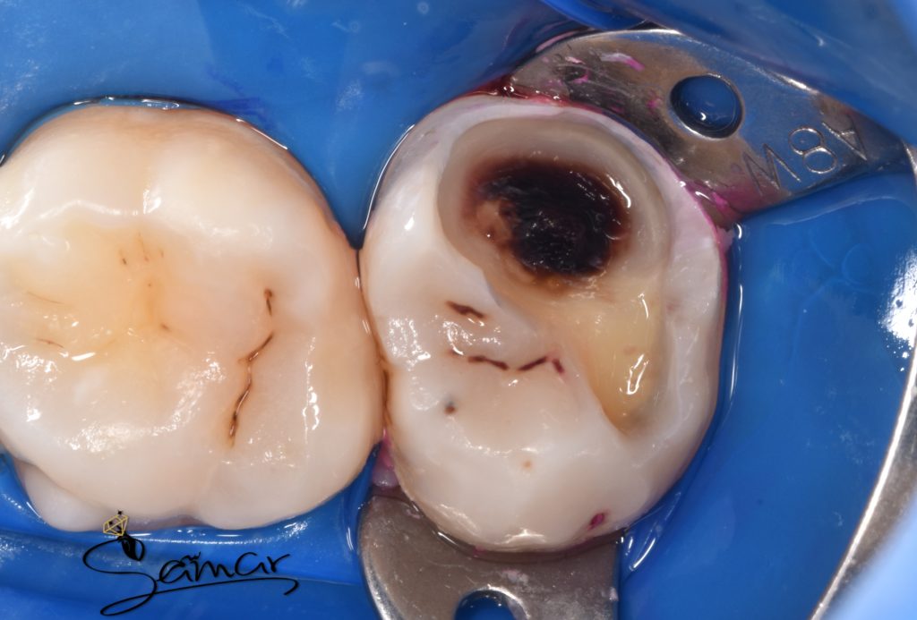 inbound133814480743626884