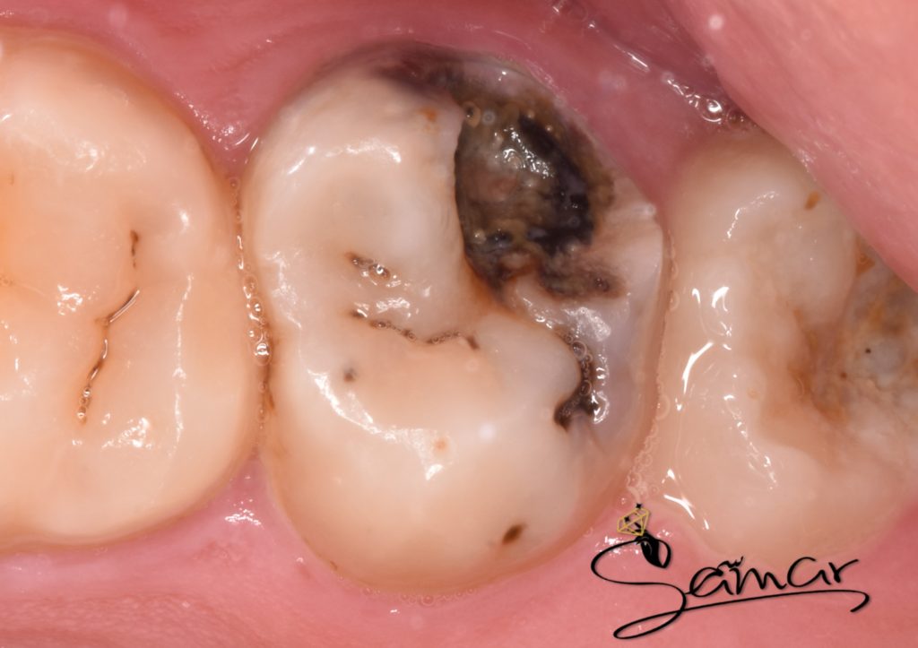 inbound2217904584785473533