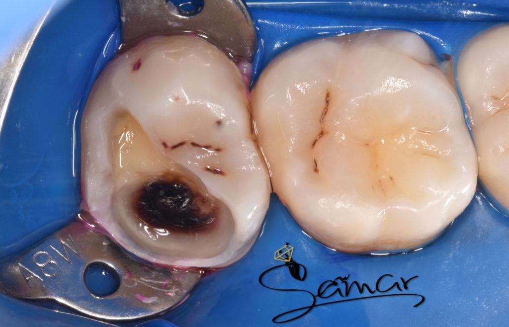 inbound3036656104713424771