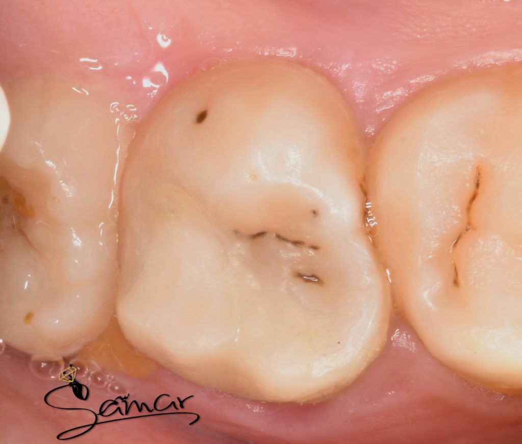 inbound3513145664612321602