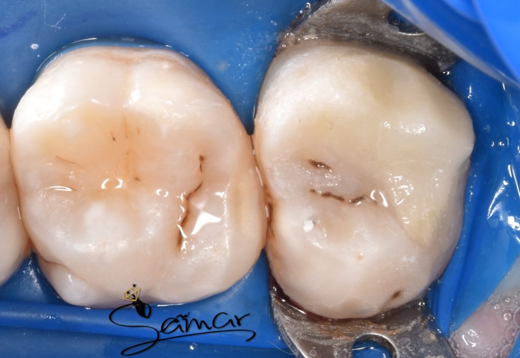 inbound5174937261951158492