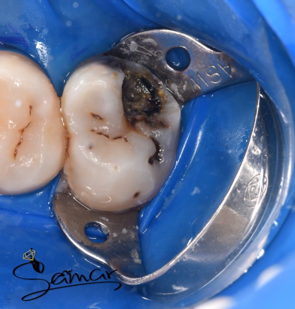 inbound5212255123213228715