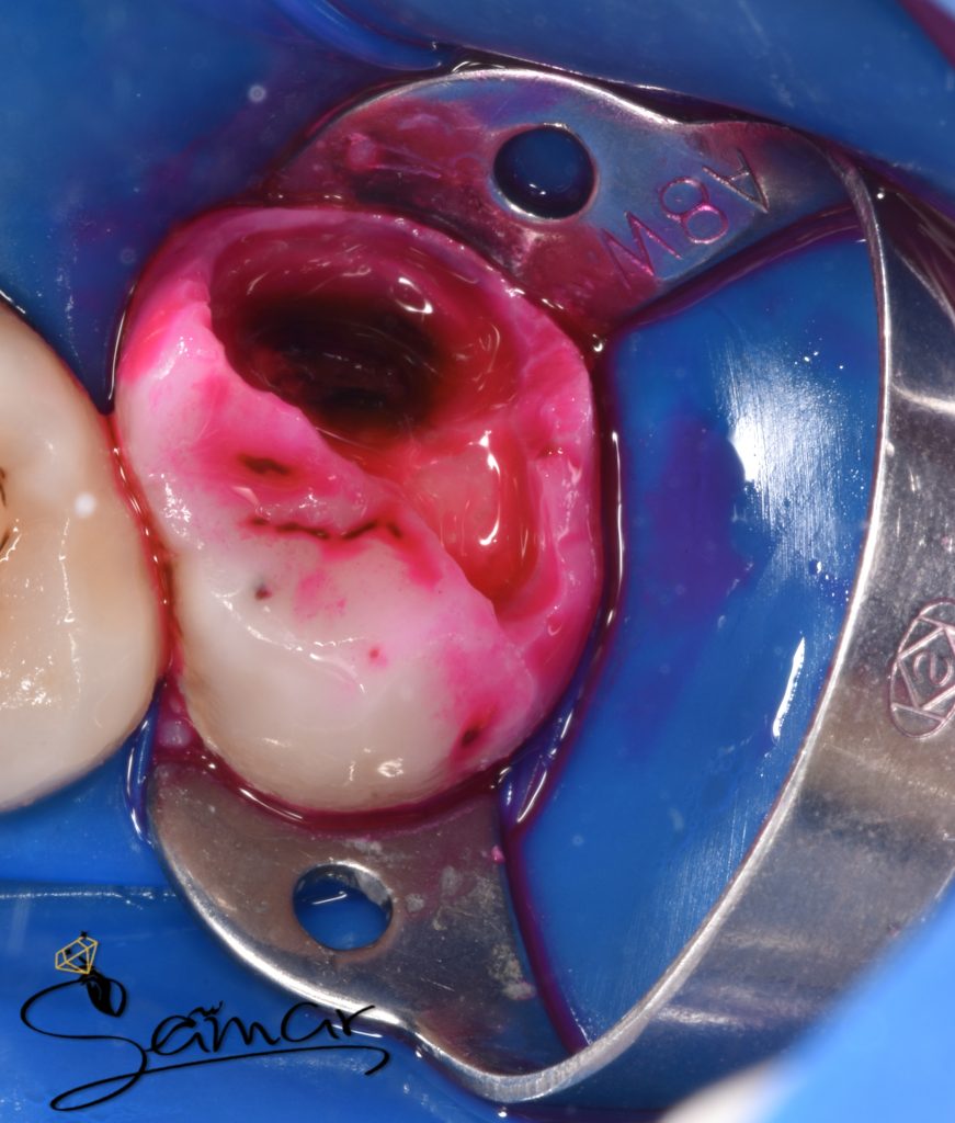 inbound5603366442019460103