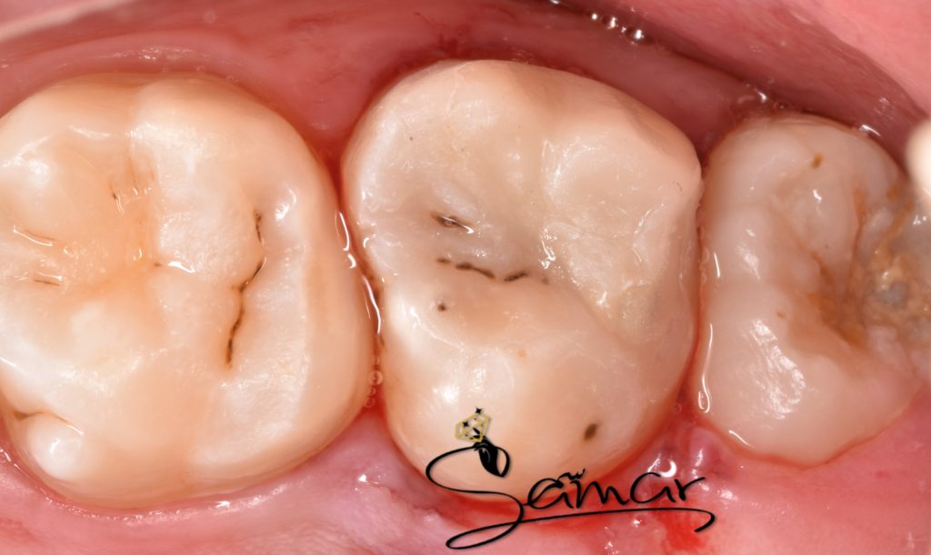 inbound6125356153672229005