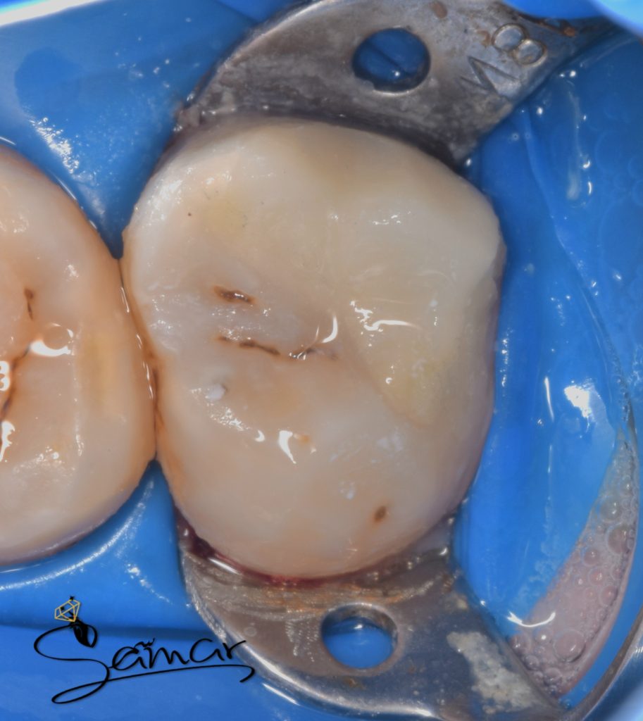 inbound6160863733163194546