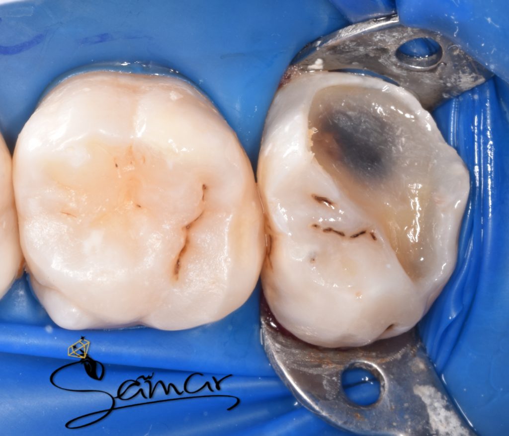 inbound6481346116589317150