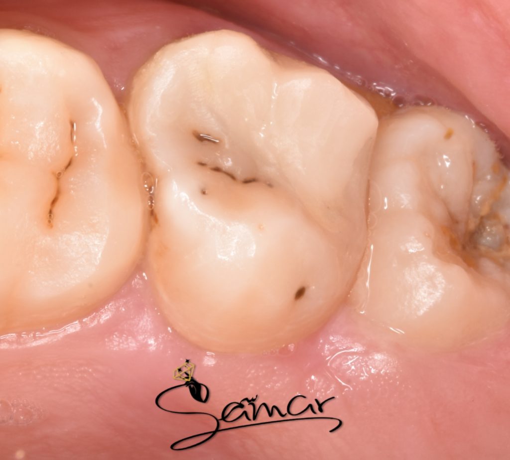 inbound6773920670925951317