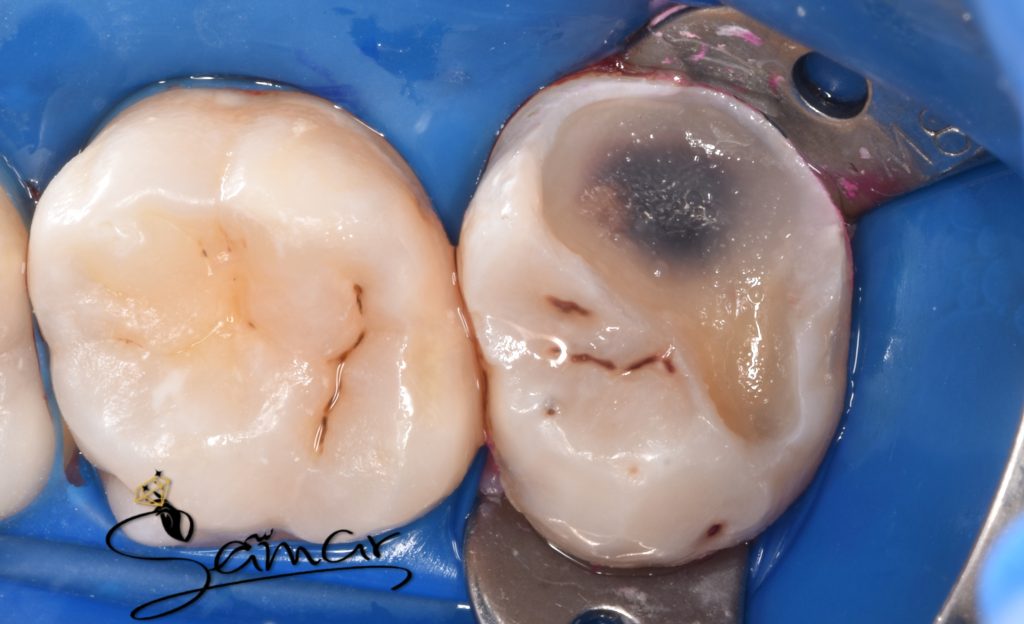 inbound7339818530354234495