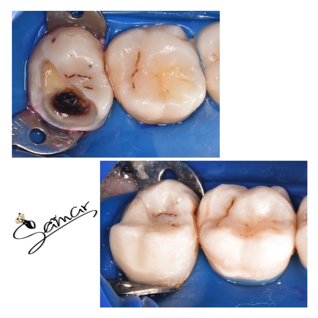 inbound7486081374754136703