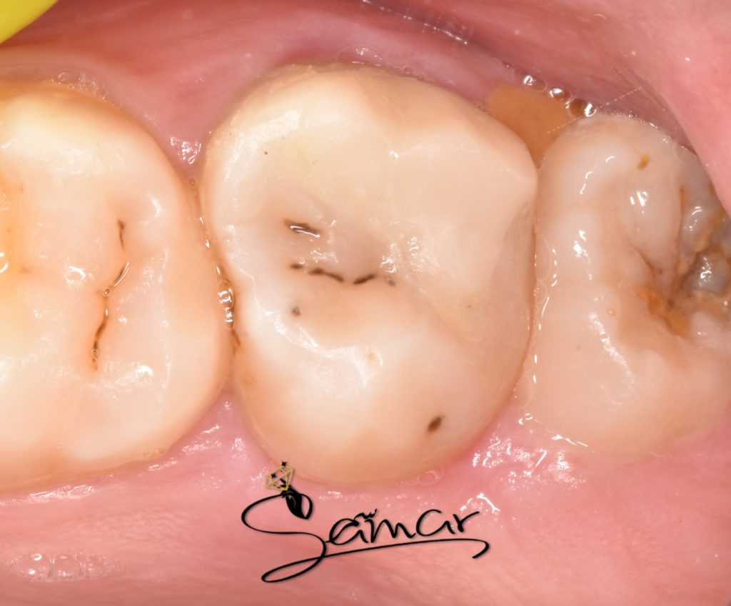 inbound8436933889349451457