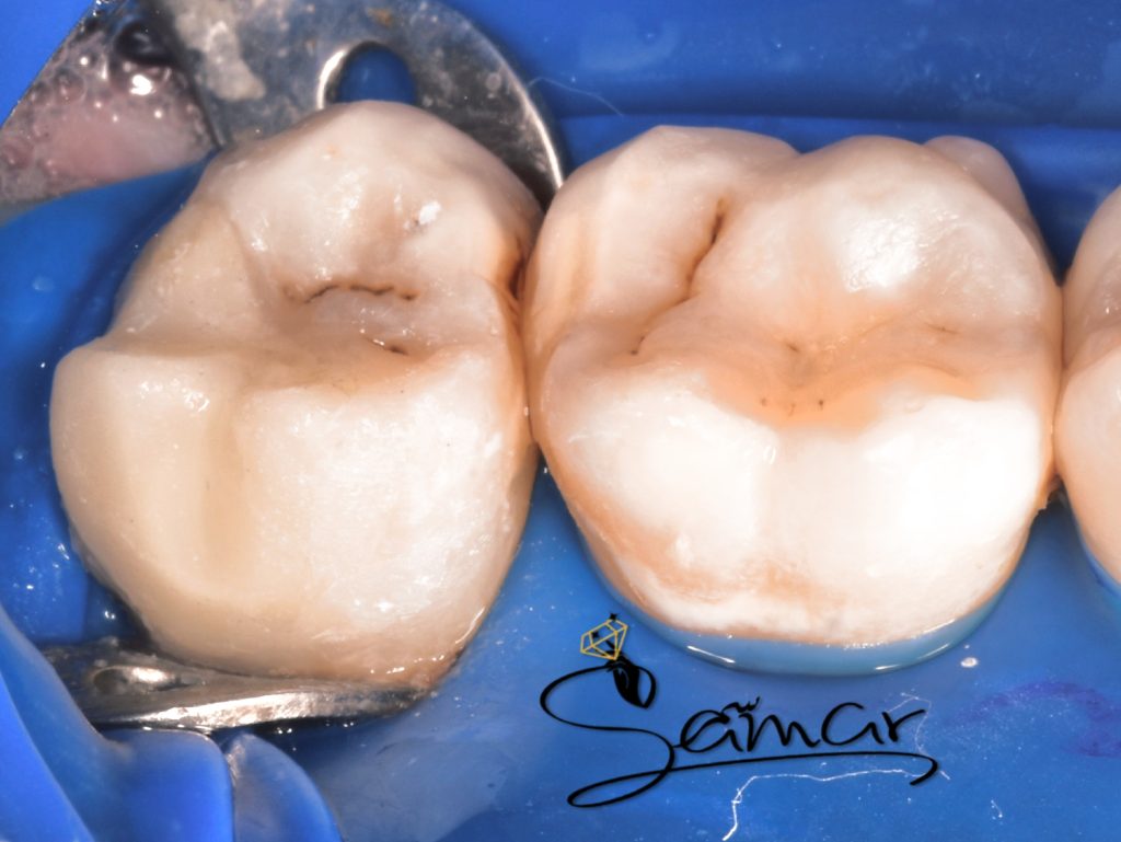 inbound8634214343816839529