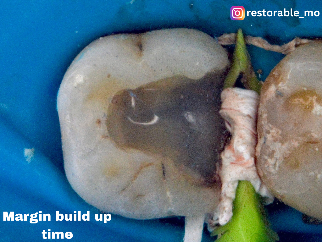 Challenging access cavity