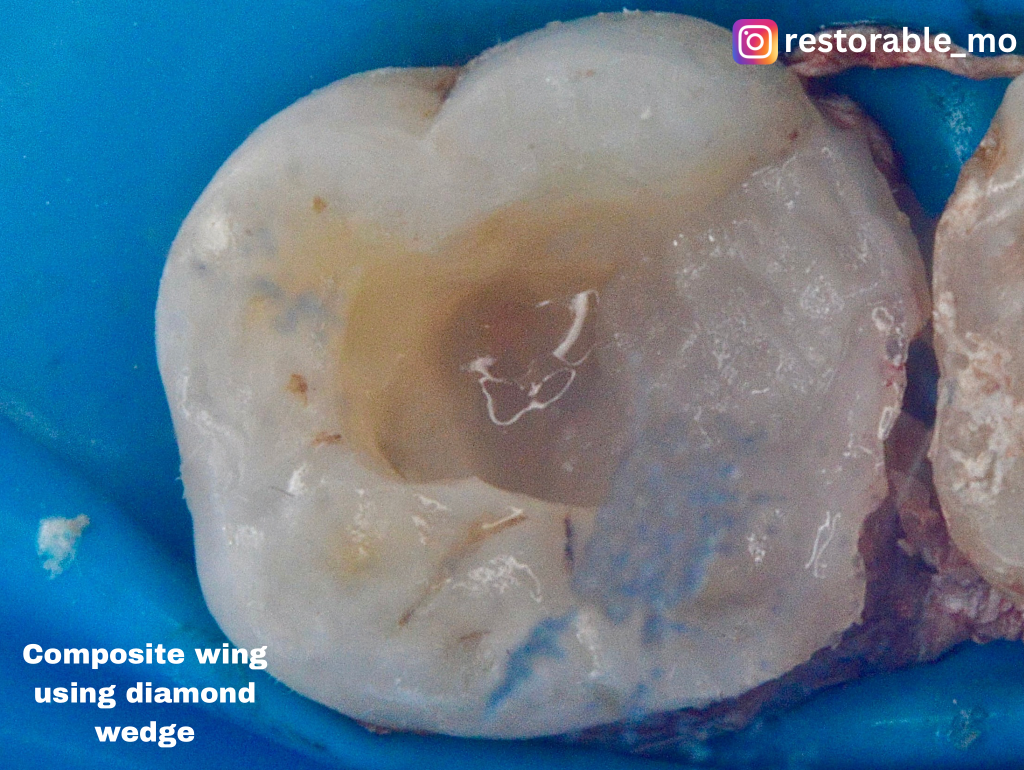 Challenging access cavity