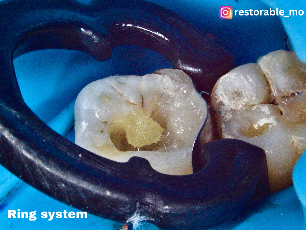 Challenging access cavity