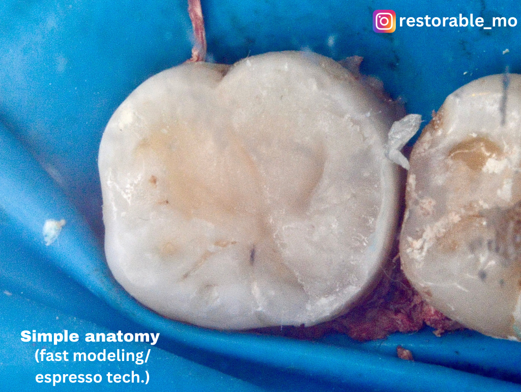 Challenging access cavity