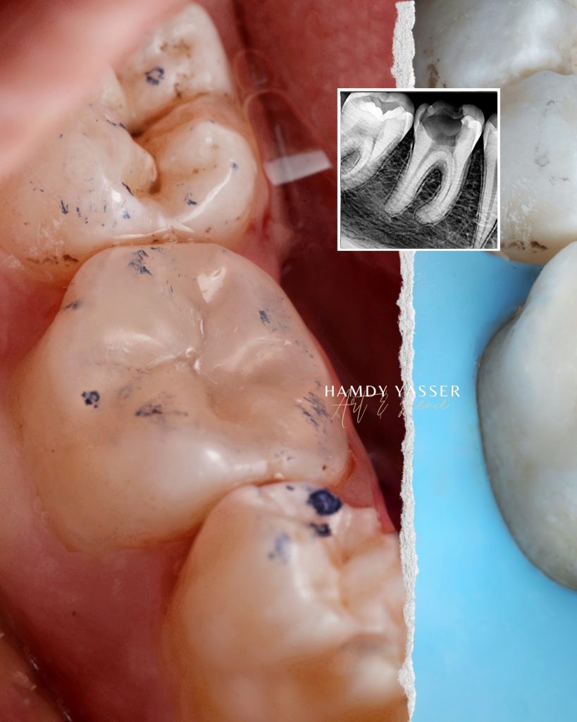 Poached Eggs, Ham off the Bone, Toasted English Muffin - 2