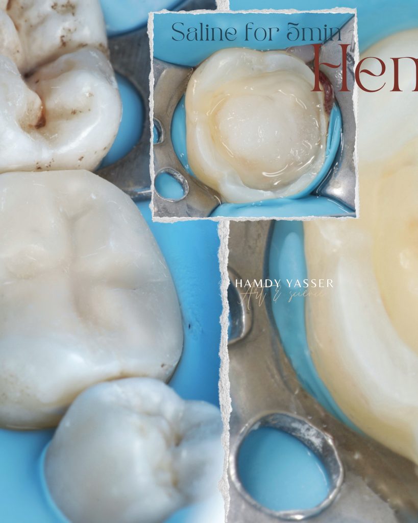 Poached Eggs, Ham off the Bone, Toasted English Muffin - 3