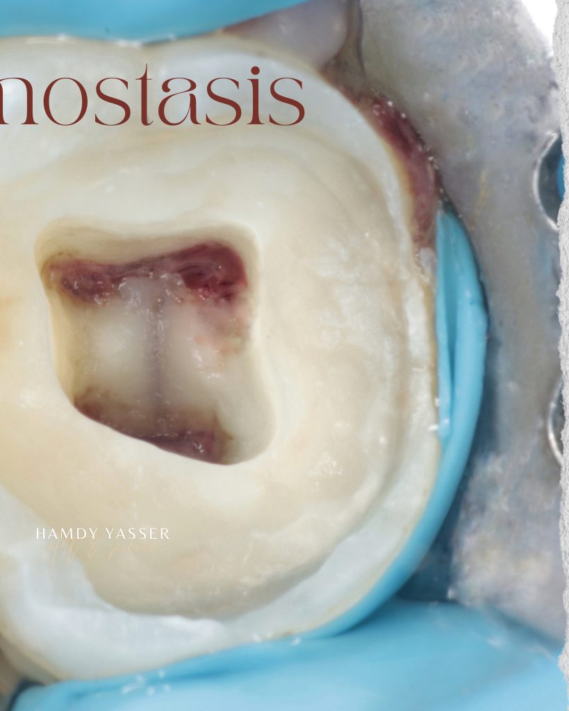 Poached Eggs, Ham off the Bone, Toasted English Muffin - 4