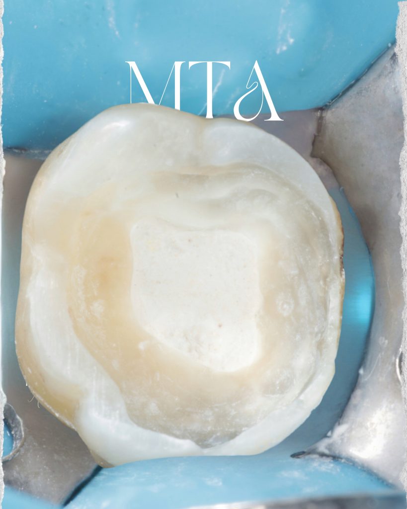 Poached Eggs, Ham off the Bone, Toasted English Muffin - 5