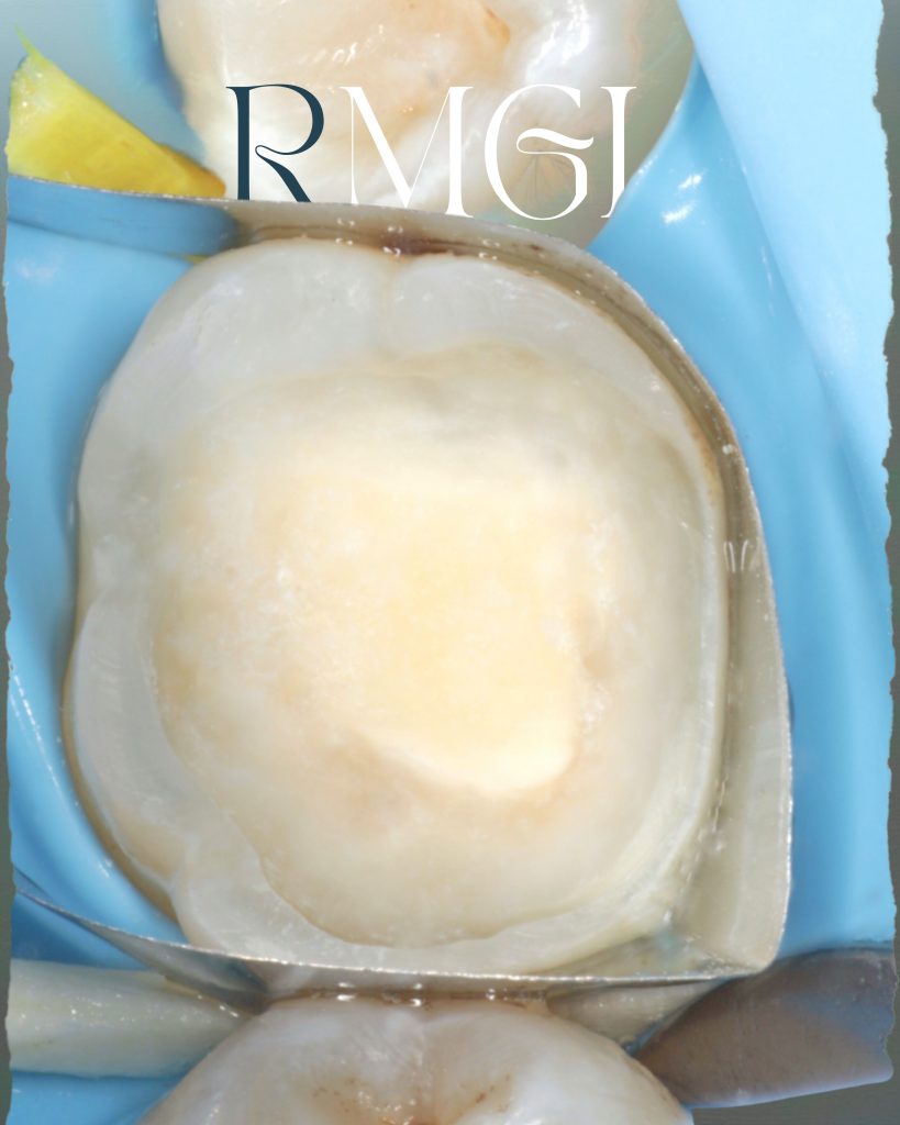 Poached Eggs, Ham off the Bone, Toasted English Muffin - 6