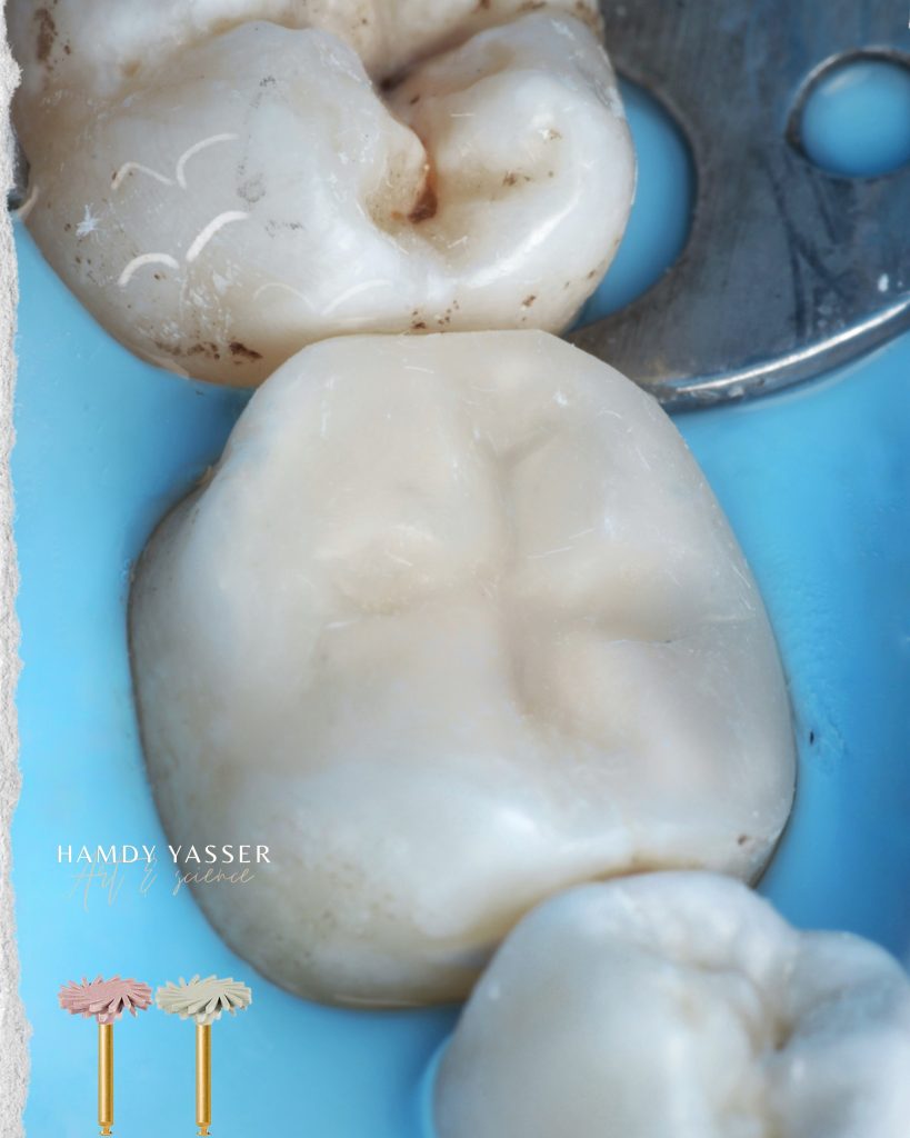 Poached Eggs, Ham off the Bone, Toasted English Muffin - 8