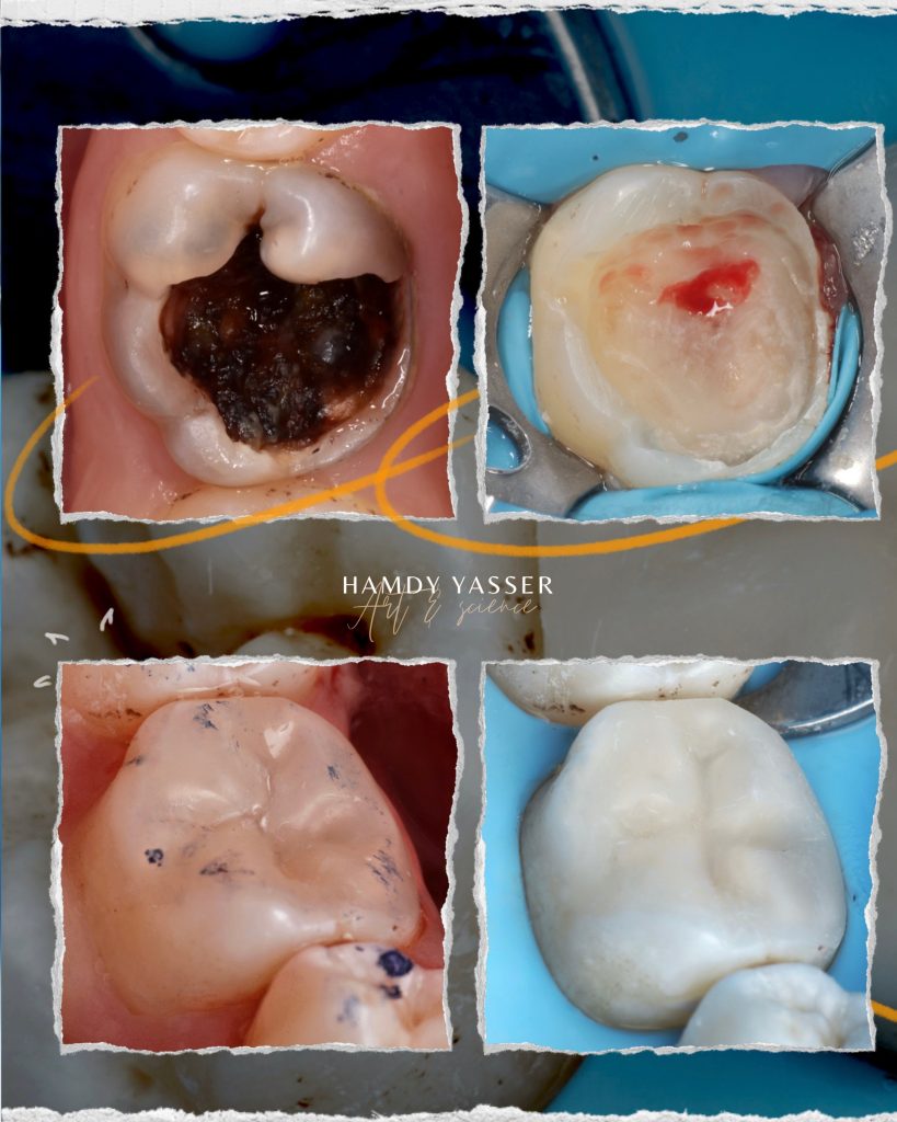 Poached Eggs, Ham off the Bone, Toasted English Muffin - 9