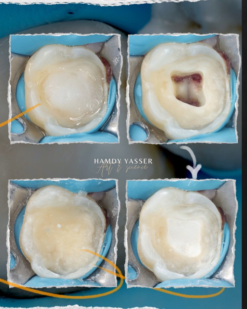 Poached Eggs, Ham off the Bone, Toasted English Muffin - 10