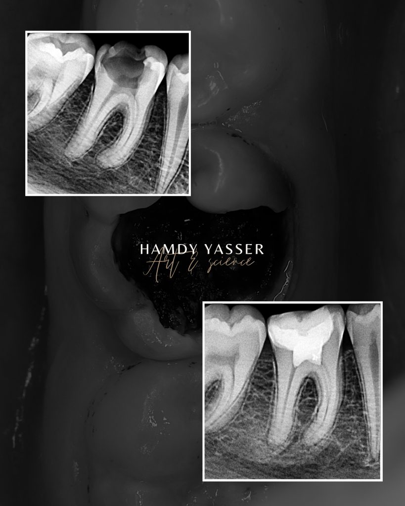 Poached Eggs, Ham off the Bone, Toasted English Muffin - 11