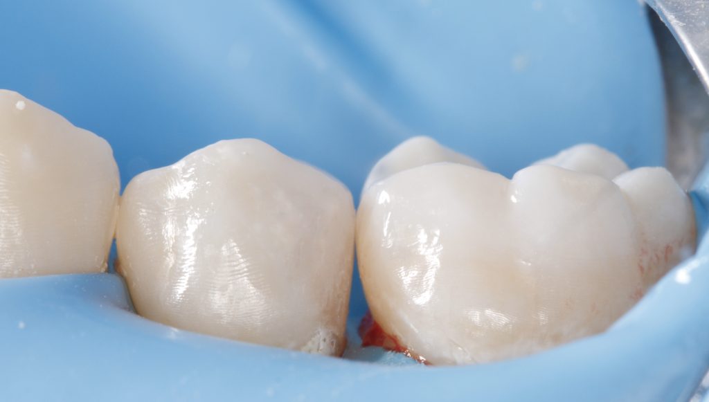 IMG_8212_SnapseedCopy