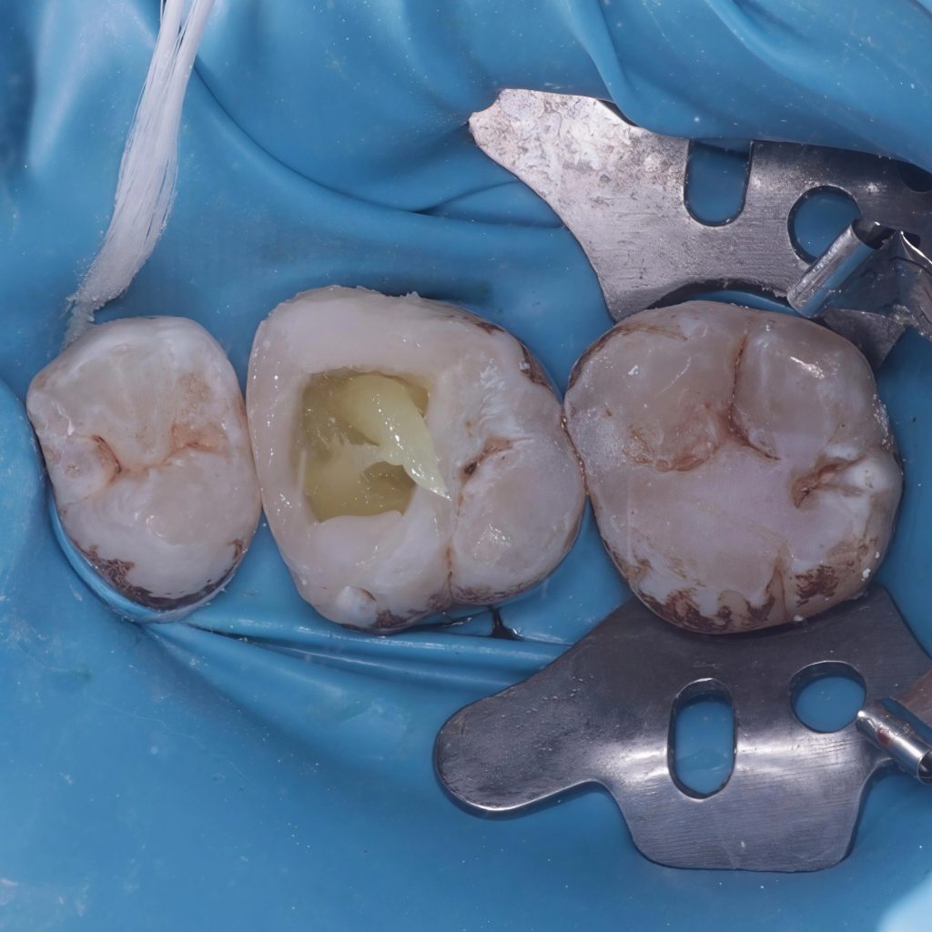 inbound2235030364423429442