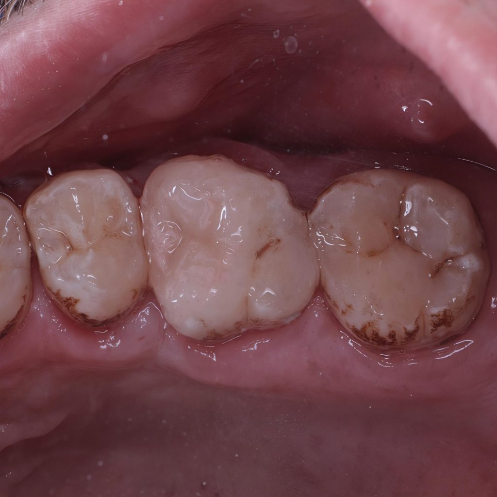 inbound2458306105824243941